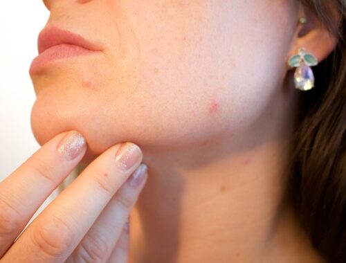 Kan hudormefjernere være skadelige for huden? Vi spørger eksperterne